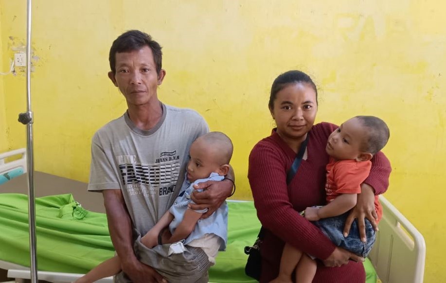 Di Lampung  Utara Kakak Beradik Alami Gizi Buruk, Ayah Harapkan Bantuan Dermawan