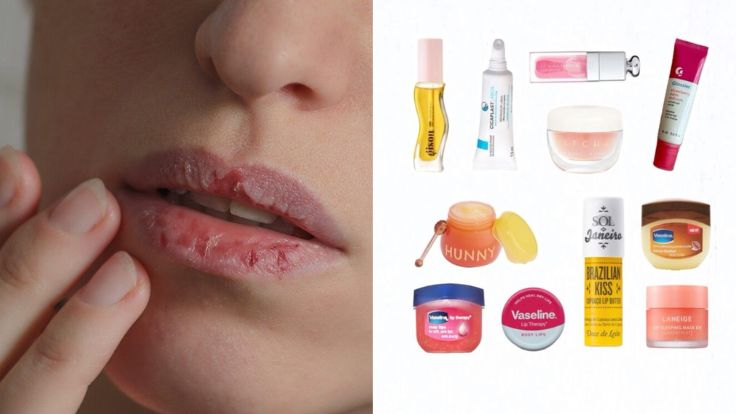Lima Rekomendasi LIp Product untuk Atasi Bibir Kering 