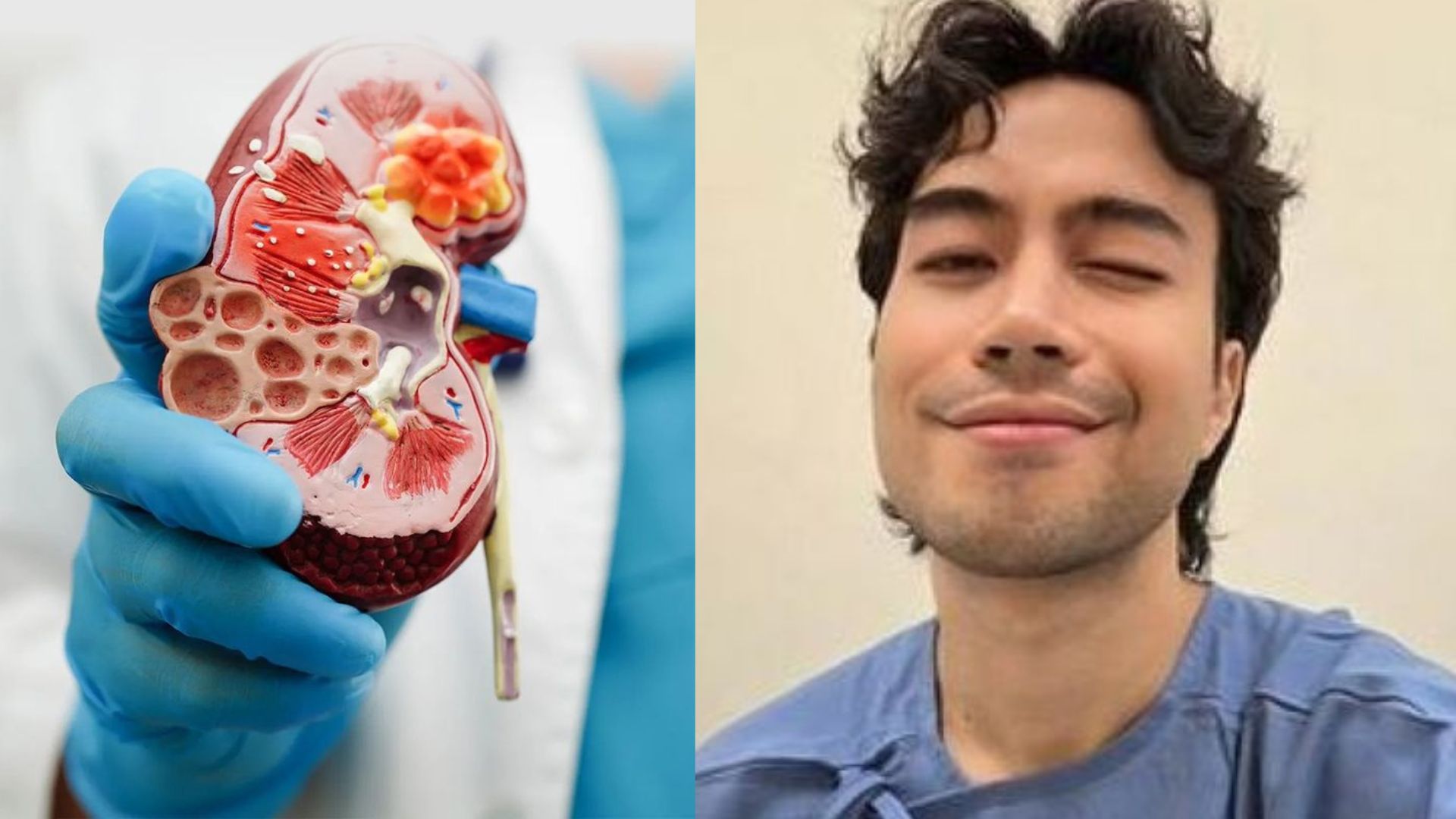 Kanker Ginjal, Penyakit yang Jarang Dibicarakan tapi Mematikan