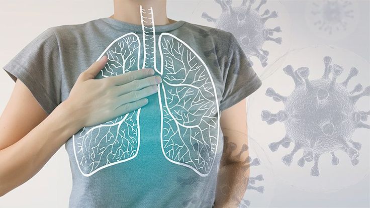 Napas Tetap Lega: Strategi Ampuh Cegah Asma Kumat