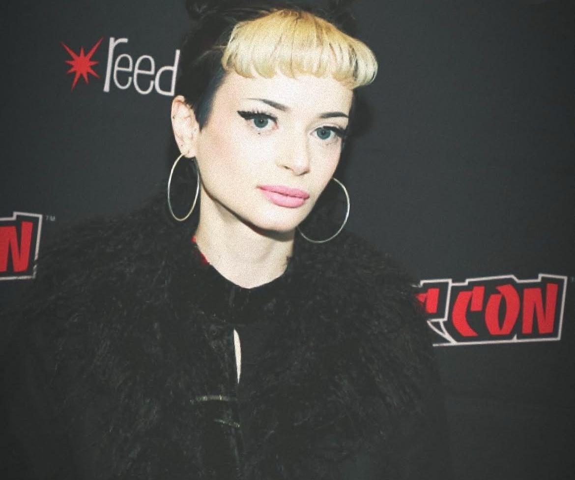 Ruth Codd Cerita Kondisinya Setelah Jalani Amputasi Kaki Kedua