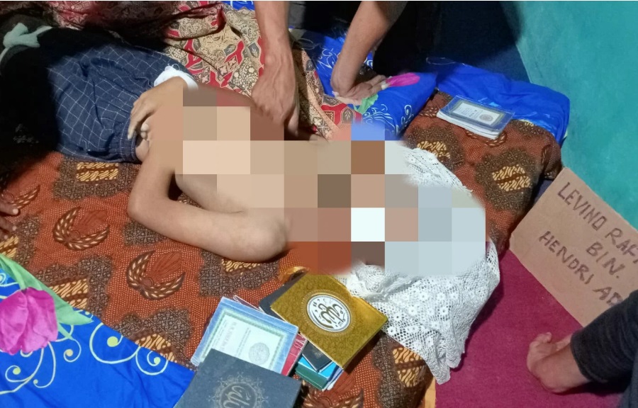 Petaka Perang Sarung “Makan Korban”, Seorang Remaja Di Kalianda Lampung MD Dengan Cidera Berat di Kepala