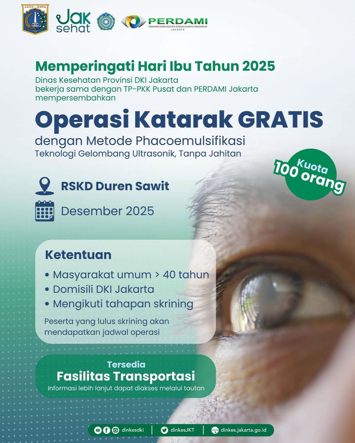 Dinkes DKI Gelar Operasi Katarak Gratis di Desember 2025, Kuota Terbatas untuk 100 Peserta