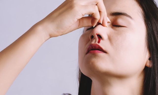 Sering Mimisan Tanpa Sebab, Jangan Panik! Mungkin ini Penyebabnya
