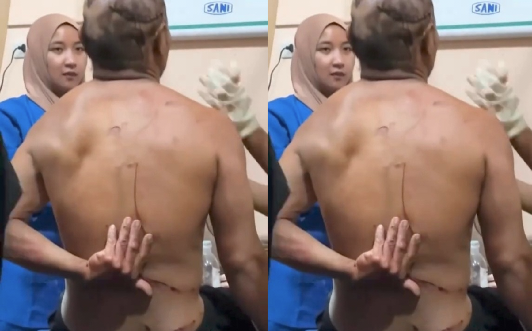 Harimau Sumatera Terkam Petani di Sekincau, Korban Dilarikan ke Puskesmas