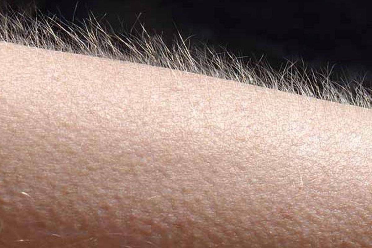 Mengapa Kita Bisa Merinding? Ternyata Ada Mode Prasejarah yang Masih Aktif di Tubuh