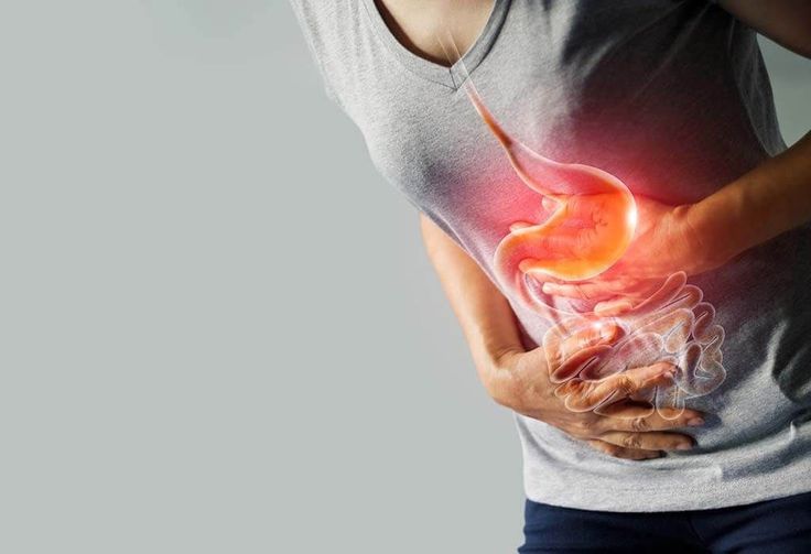 Asam Lambung Sering Kambuh? Ini Kebiasaan yang Perlu Dihindari dan Cara Meredakannya