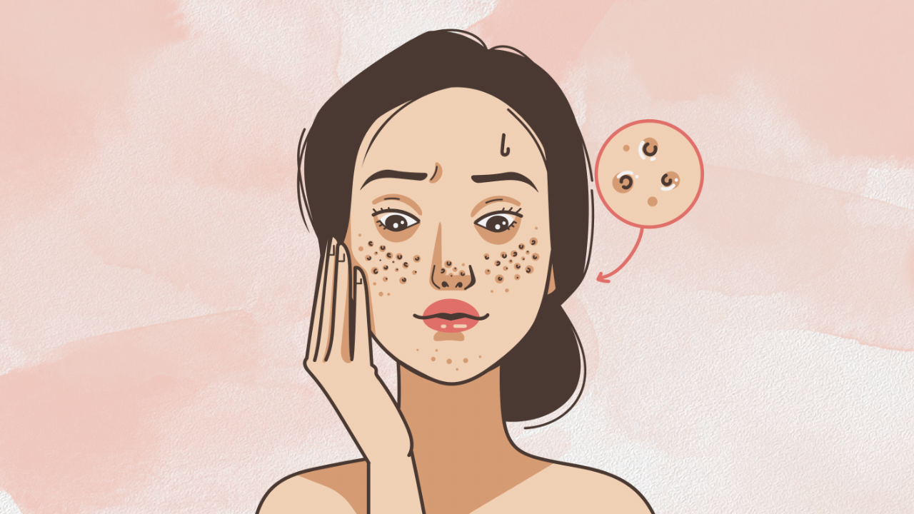 Bahaya Tidur dengan Makeup: Pentingnya Membersihkan Wajah di Malam Hari