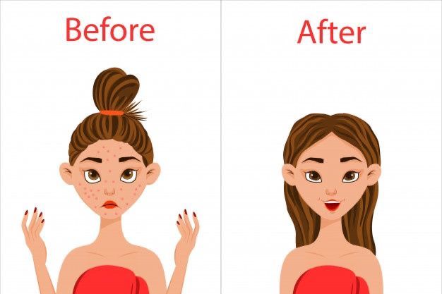 Glow-Up Challenge di Instagram: Ajang Ekspresi Percaya Diri Generasi Z