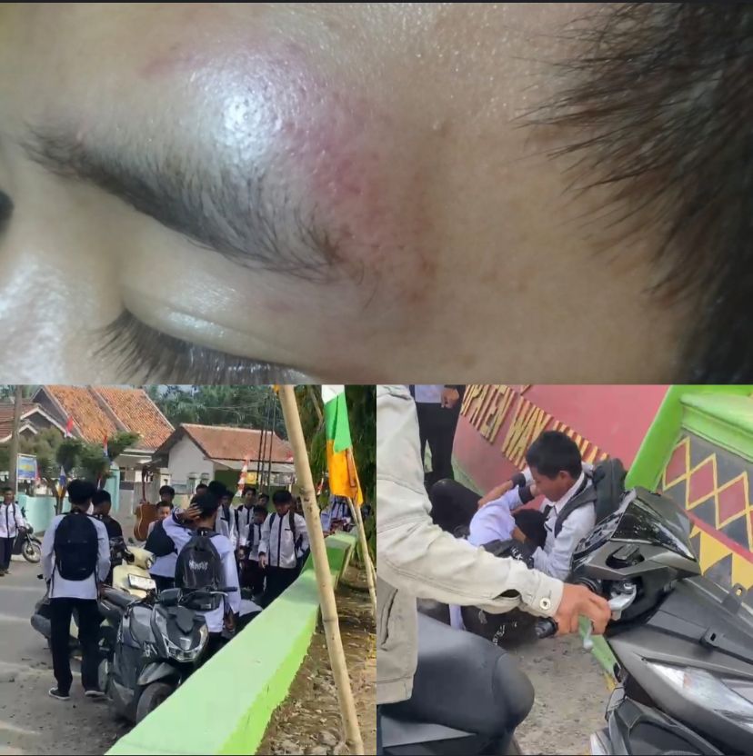 Gara-Gara Bilang Temen Bolos, Ketua Kelas Di Way Kanan Dikeroyok