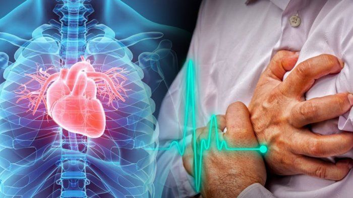 Nyeri Dada Mendadak saat Usia Muda, Jangan Langsung Menganggapnya akibat Kelelahan