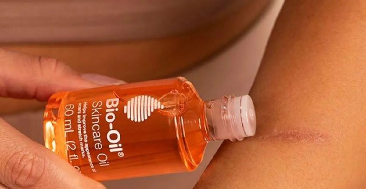 Bio Oil, Minyak Ajaib dengan Segudang Manfaat untuk Kulit Sehat dan Cantik