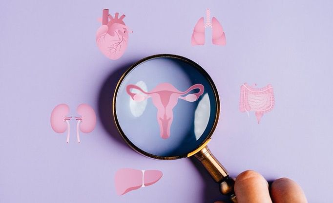 Dunia Medis Resmi Ubah Nama PCOS Jadi PMOS, Ini Alasannya