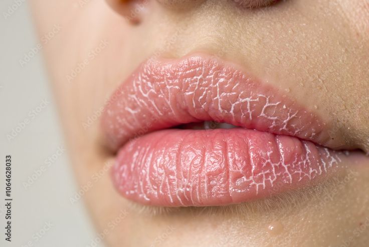 Rahasia Bibir Sehat dan Merah Alami: Panduan Perawatan dari Dalam dan Luar