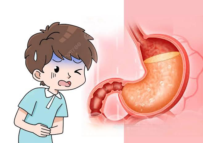 Anak Muda Rentan GERD, Pola Hidup Tak Sehat Jadi Pemicu Utama