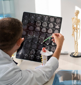 Hari Kesadaran Glioblastoma: Saatnya Lampung Lebih Peduli Kanker Otak