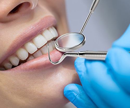 Scaling Gigi Bisa Ditanggung BPJS Kesehatan, Simak Syarat dan Alurnya  