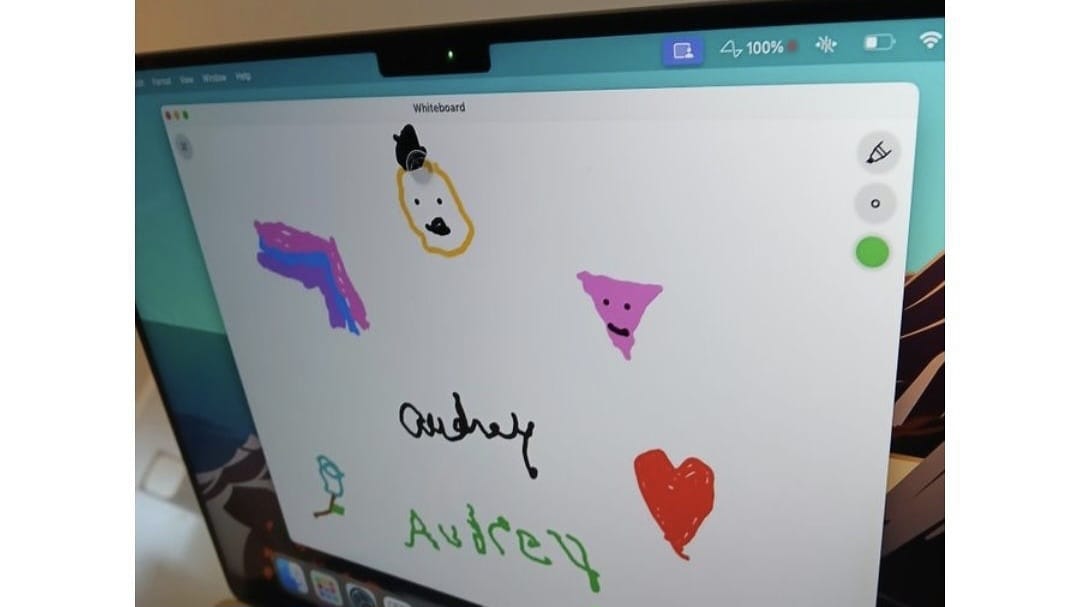 Audrey Crews, Wanita Pertama dengan Implan Neuralink, Berhasil 