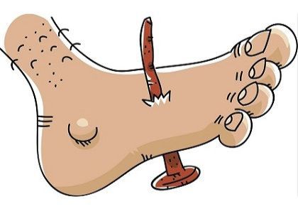 Waspadai Tetanus: Infeksi Berbahaya yang Bisa Mengancam Nyawa Akibat Luka Terinfeksi Bakteri