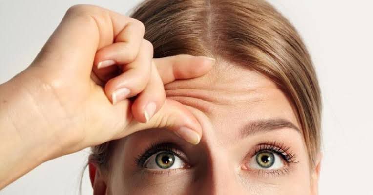 Stres Bisa Mempercepat Munculnya Kerutan di Wajah, Begini Penjelasannya