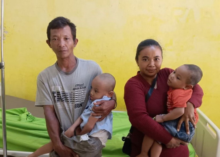 Di Lampung  Utara Kakak Beradik Alami Gizi Buruk, Ayah Harapkan Bantuan Dermawan