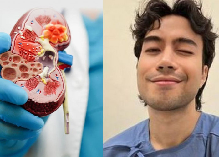 Kanker Ginjal, Penyakit yang Jarang Dibicarakan tapi Mematikan