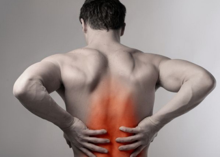 Jangan Remehkan Nyeri Punggung! Ini 5 Trik Cerdas Cegah Saraf Terjepit akibat Terlalu Lama Duduk Bekerja