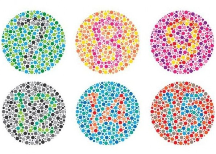 Bukan Hitam Putih: Realita Spektrum Warna bagi Penderita Defisiensi Mata