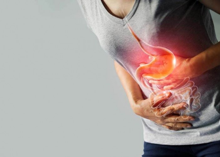 Asam Lambung Sering Kambuh? Ini Kebiasaan yang Perlu Dihindari dan Cara Meredakannya