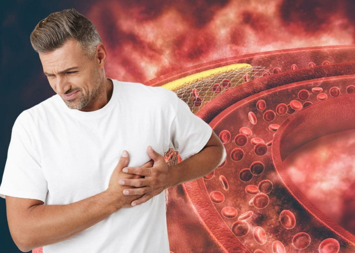 Kasat Mata! Ini Adalah Tanda-tanda Tubuh Kamu Kelebihan Kandungan Kolesterol 