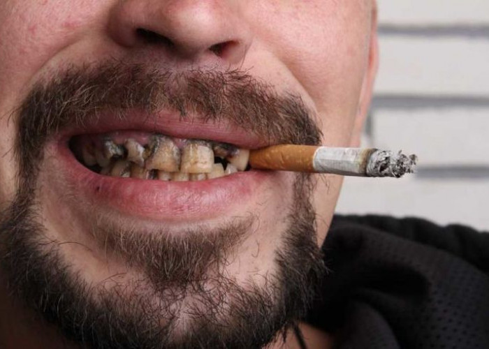 Perhatikan Dampak Merokok Berikut Yang Dapat Terjadi Pada Tubuh Anda!