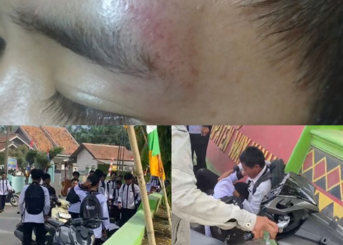 Gara-Gara Bilang Temen Bolos, Ketua Kelas Di Way Kanan Dikeroyok