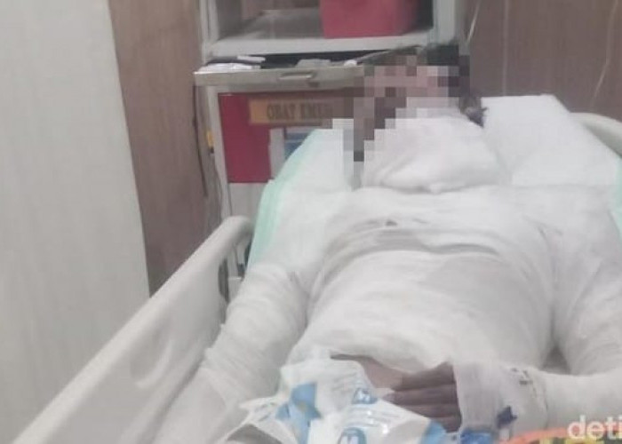 Polisi Amankan Bos Truk Usai Bakar Anak Buahnya karena Masalah Setoran 