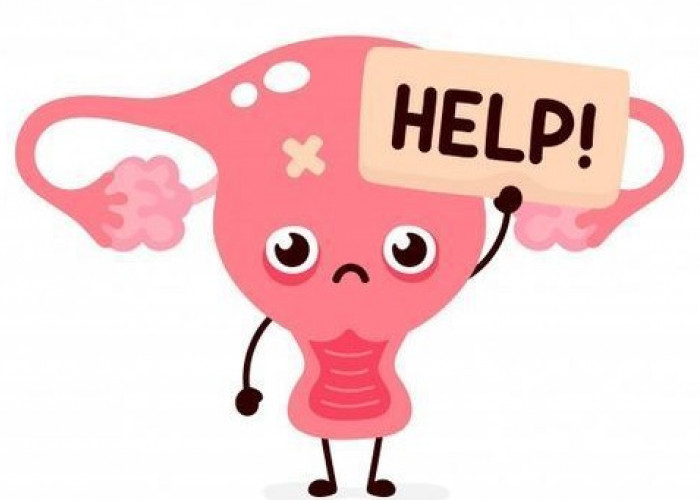 Mengenal PCOS, Gangguan Hormon yang Sering Dialami Perempuan