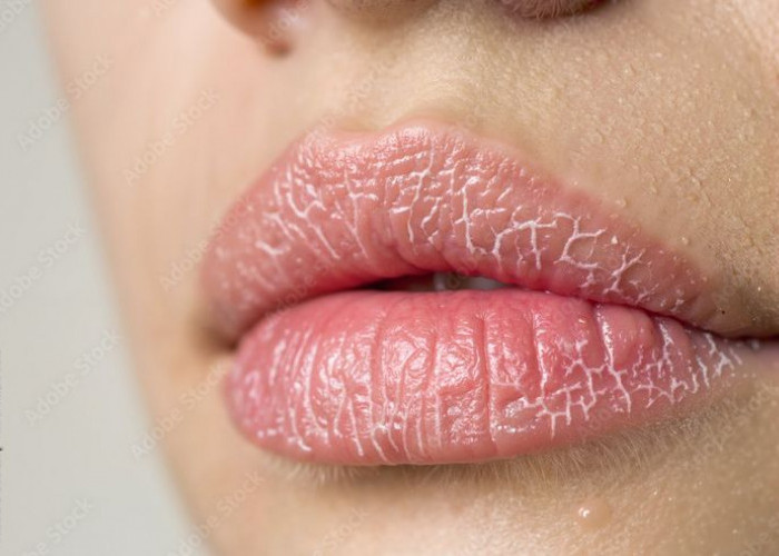 Rahasia Bibir Sehat dan Merah Alami: Panduan Perawatan dari Dalam dan Luar