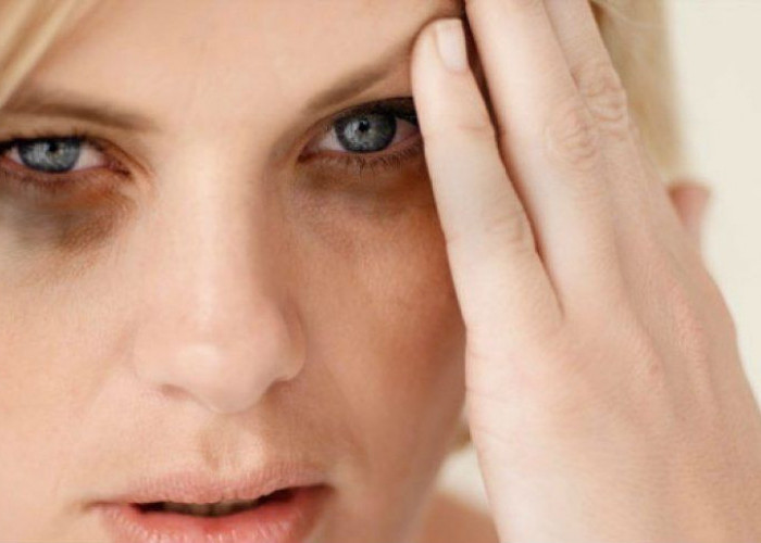 Kembalikan Kesegaran Wajah: Tips Ampuh Menghilangkan Mata Panda secara Alami dan Efektif