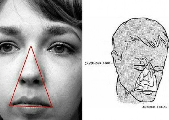 Memahami Area Segitiga Wajah atau Triangle of Death