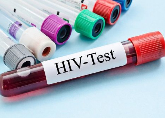 Data DCC Ungkap 522 Anak dan Remaja di Sidoarjo Terinfeksi HIV, Disdikbud Siapkan Mitigasi
