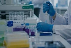 Peneliti di Rusia Meninggal Dunia Diduga Terinfeksi Wabah 'Misterius'