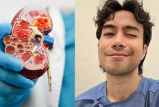 Kanker Ginjal, Penyakit yang Jarang Dibicarakan tapi Mematikan