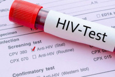 Kasus HIV Bandar Lampung Meningkat, Kenali Risiko dan Cara Penjegahannya