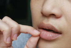 Bibir Kering dan Pecah-Pecah? Kenali Penyebab dan Cara Mengatasinya