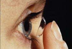 Softlens, Diantara Pilihan Estetik dan Risiko Serius Kesehatan Mata