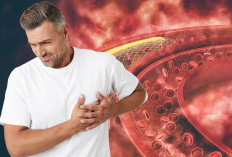 Kasat Mata! Ini Adalah Tanda-tanda Tubuh Kamu Kelebihan Kandungan Kolesterol 