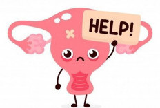 Mengenal PCOS, Gangguan Hormon yang Sering Dialami Perempuan