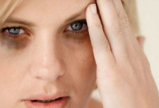 Kembalikan Kesegaran Wajah: Tips Ampuh Menghilangkan Mata Panda secara Alami dan Efektif