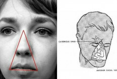 Memahami Area Segitiga Wajah atau Triangle of Death