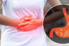 Penderita Asam Lambung Perlu Lebih Selektif, Konsumsi Buah Tertentu Dapat Memicu Gejala Kambuh