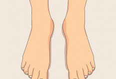 Sering Menggerakkan Kaki Tanpa Sadar? Waspadai Restless Legs Syndrome (RLS)